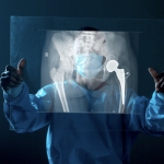 kalça protezi röntgen