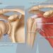Rotator cuff kasları hangileridir? Fonksiyonları nedir?
